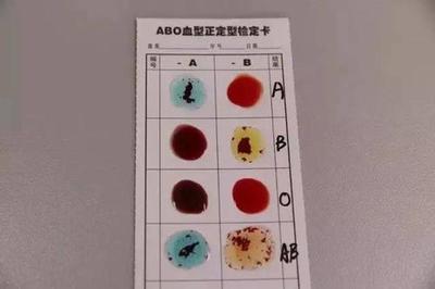 血型鉴定的方法